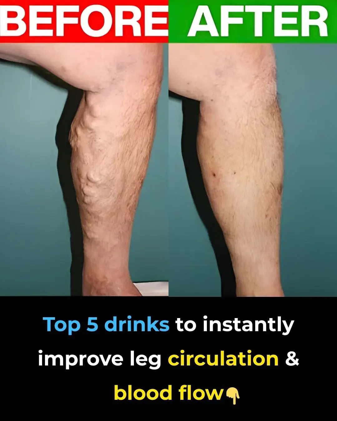 Top 5 des boissons pour améliorer INSTANTANÉMENT la circulation des jambes et le flux sanguin